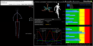 Sistema completo Motion Metrix 1.0. Analisis de la marcha en carrera 3D. - Ítem1