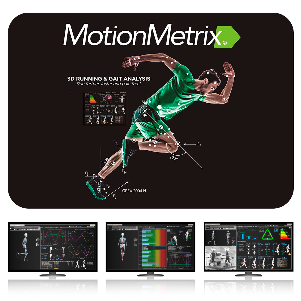 Sistema completo Motion Metrix 1.0. Analisis de la marcha en carrera 3D.